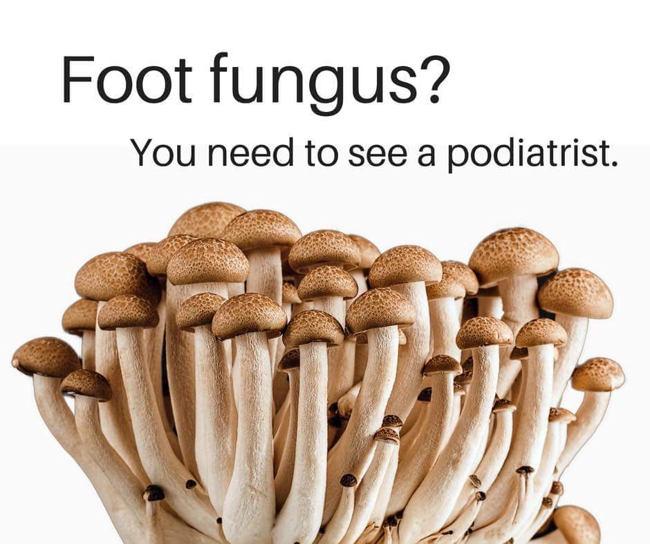 Foot fungus graphic